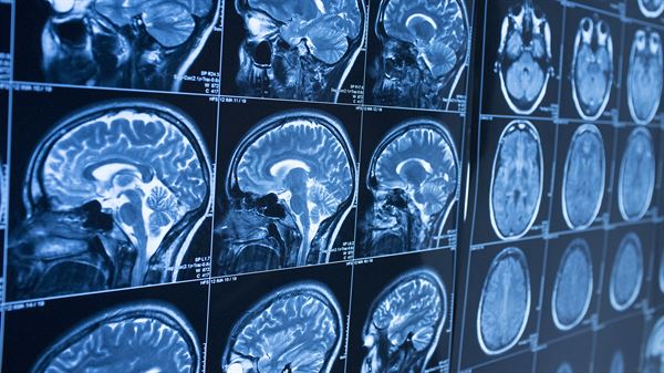 Symptom recognition and prompt medical attention key to concussion recovery 