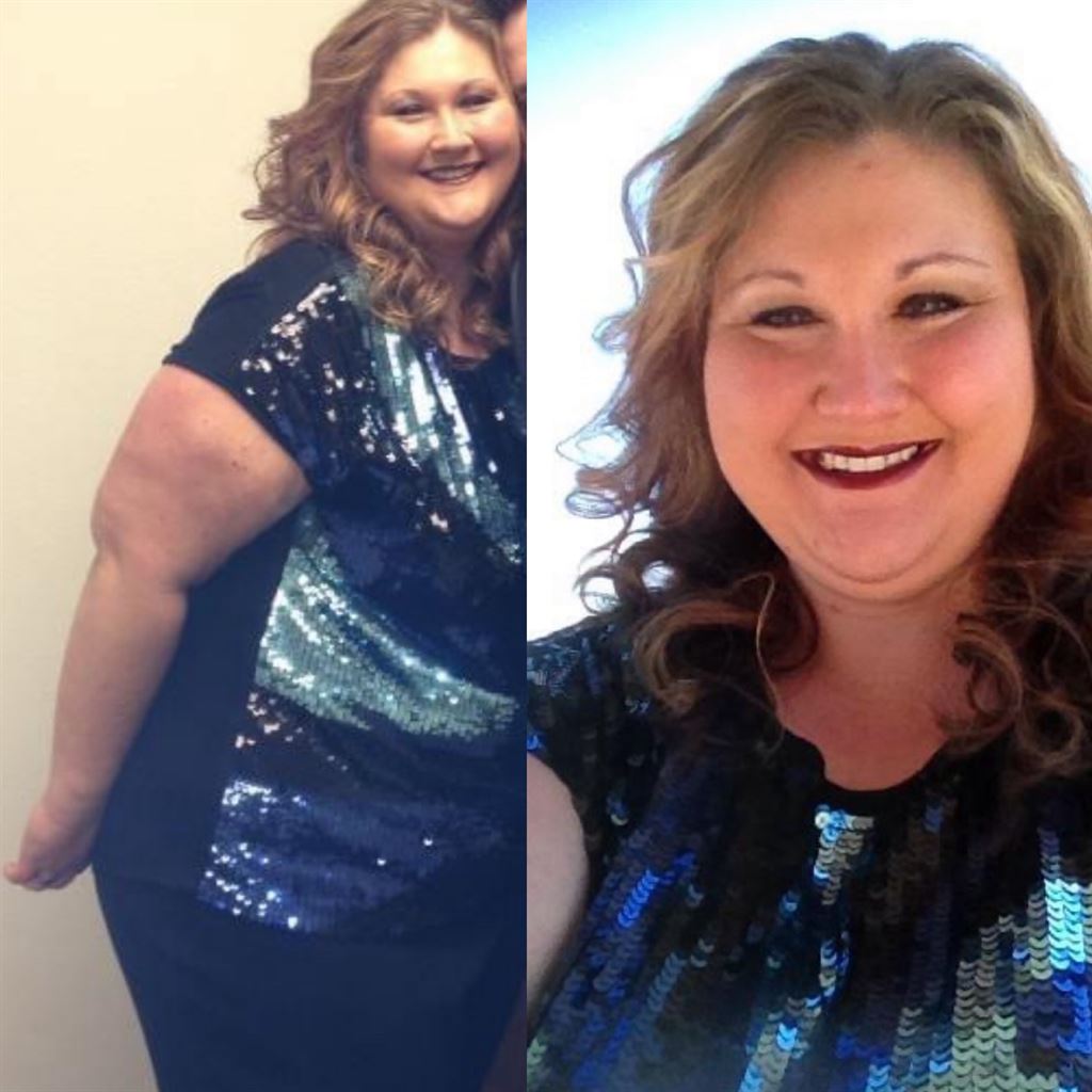 Photos of Staci Horton before her weight-loss journey.