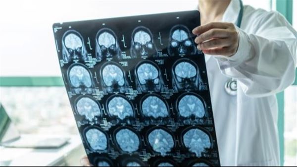 WVU Medicine specialist urges early evaluation for memory concerns 