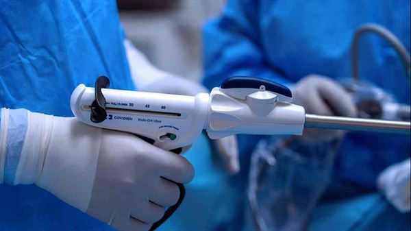 Bariatric surgery FAQ: Part 2 