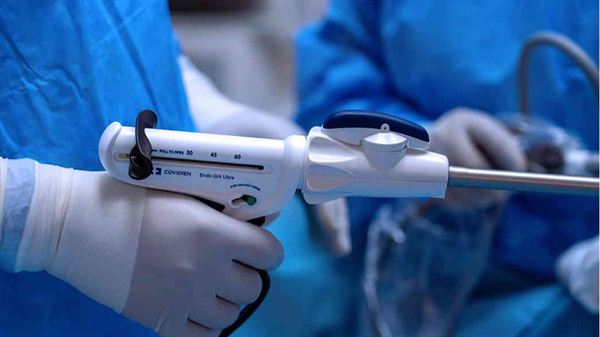 Bariatric surgery FAQ: Part 2 