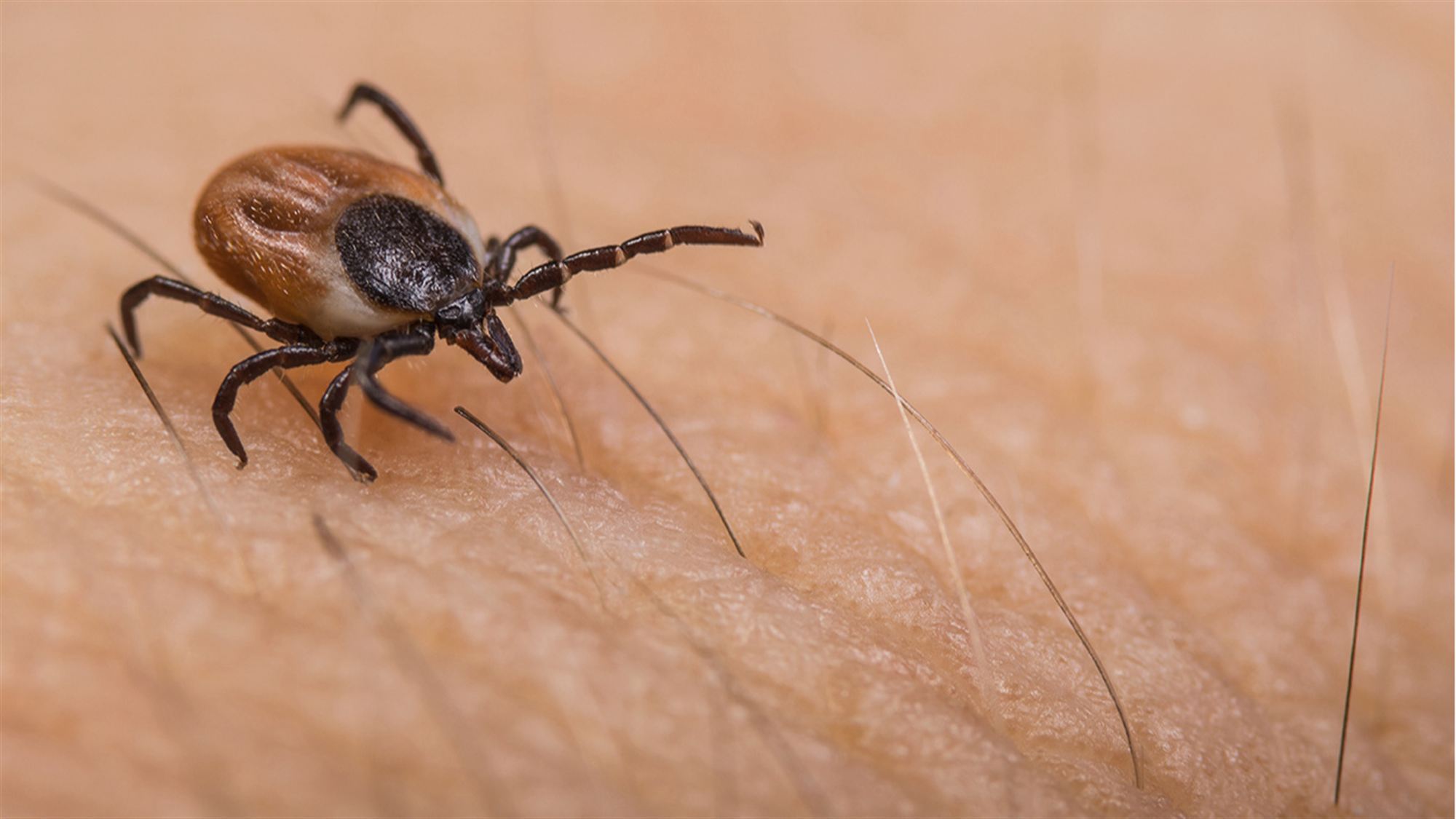 Tick Talk: How to keep yourself safe from these pesky critters