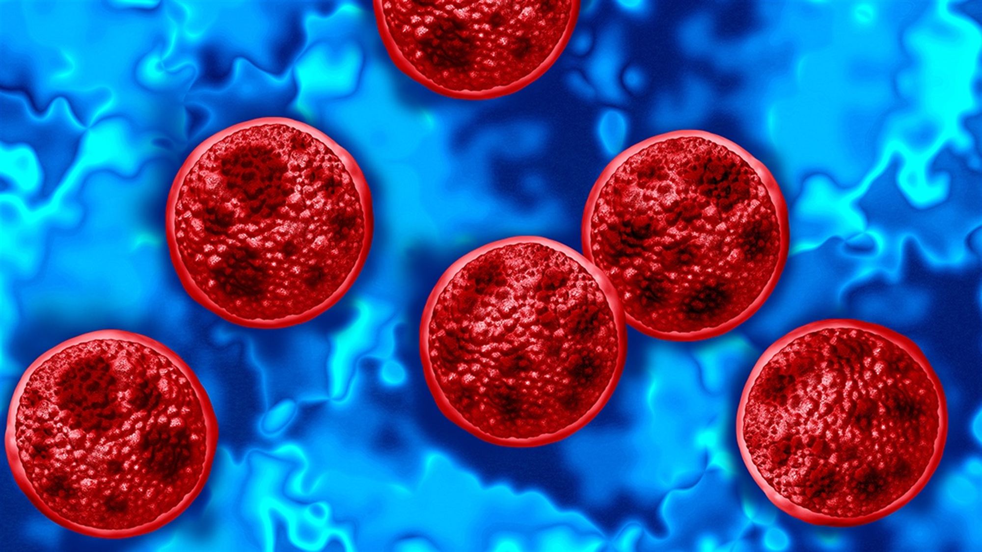 Summer Bummer Part Two: What you should know about cyclospora