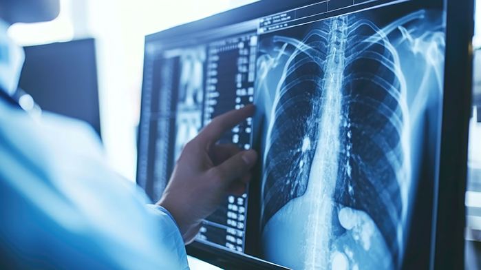 Lung cancer pic 2.jpg