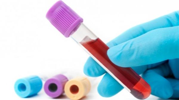 WVU Medicine St. Joseph’s Hospital and Rotary Club of Buckhannon Upshur to Host Fall Community Blood Screenings