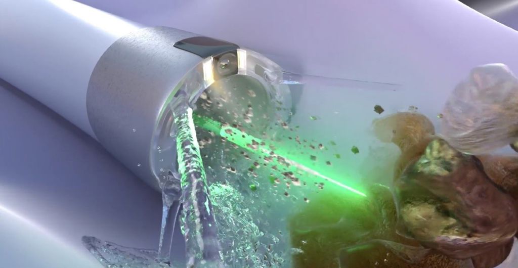 Local urologist continues to bring new technology to the patients of ...
